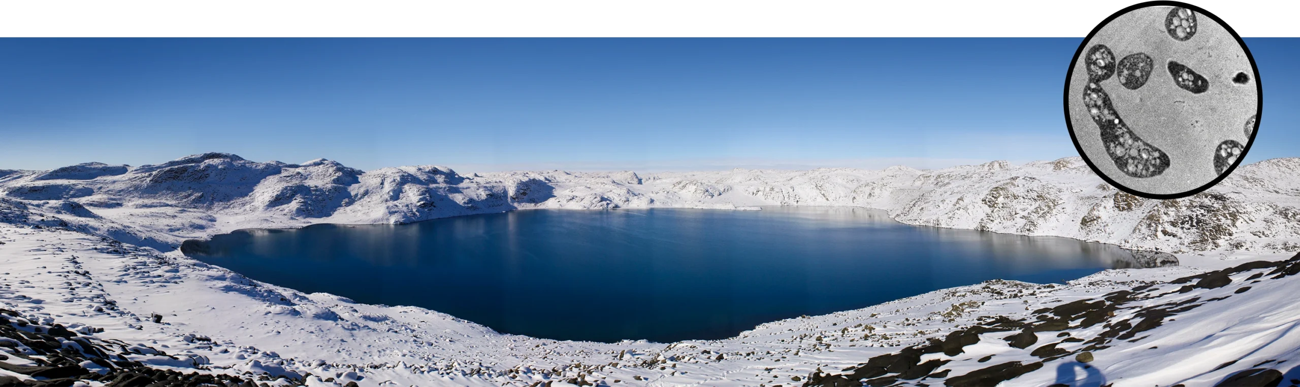 Main image: A still, glassy lake in Antarctica surrounded by rocky, snow-patched terrain. Side image: Electron micrograph of oval and elongated microbe cells with granular, bubble-like internal structures, against a light grey background