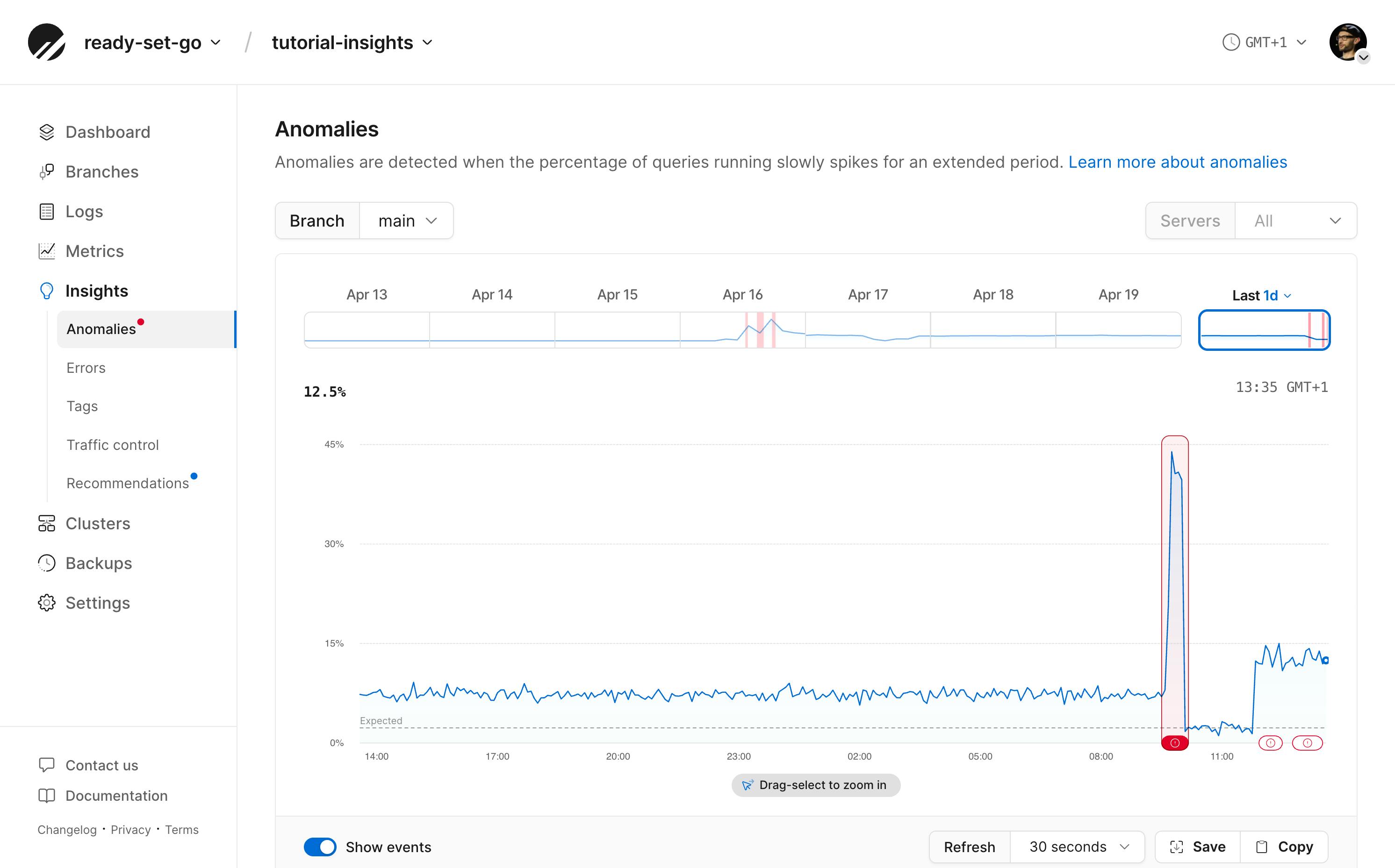 Insights anomalies page